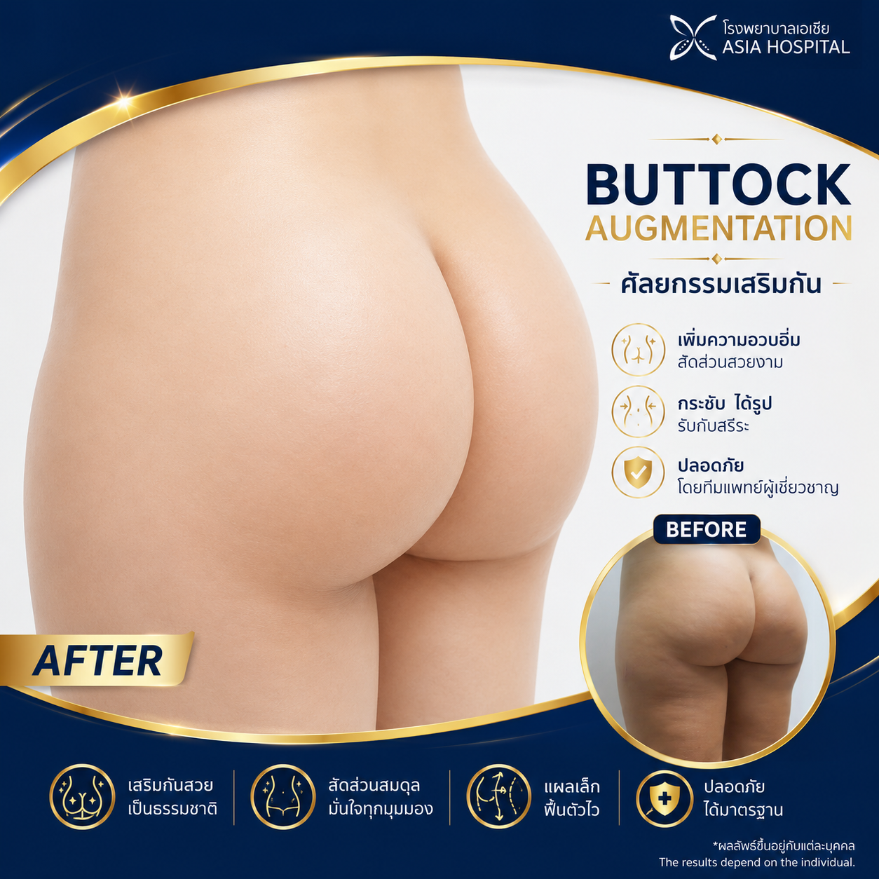 ศัลยกรรมรูปร่าง ก่อน-หลัง