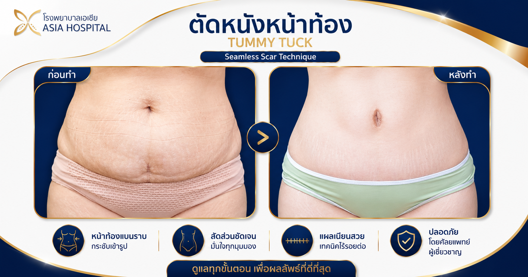 ก่อน-หลัง ศัลยกรรมรูปร่าง