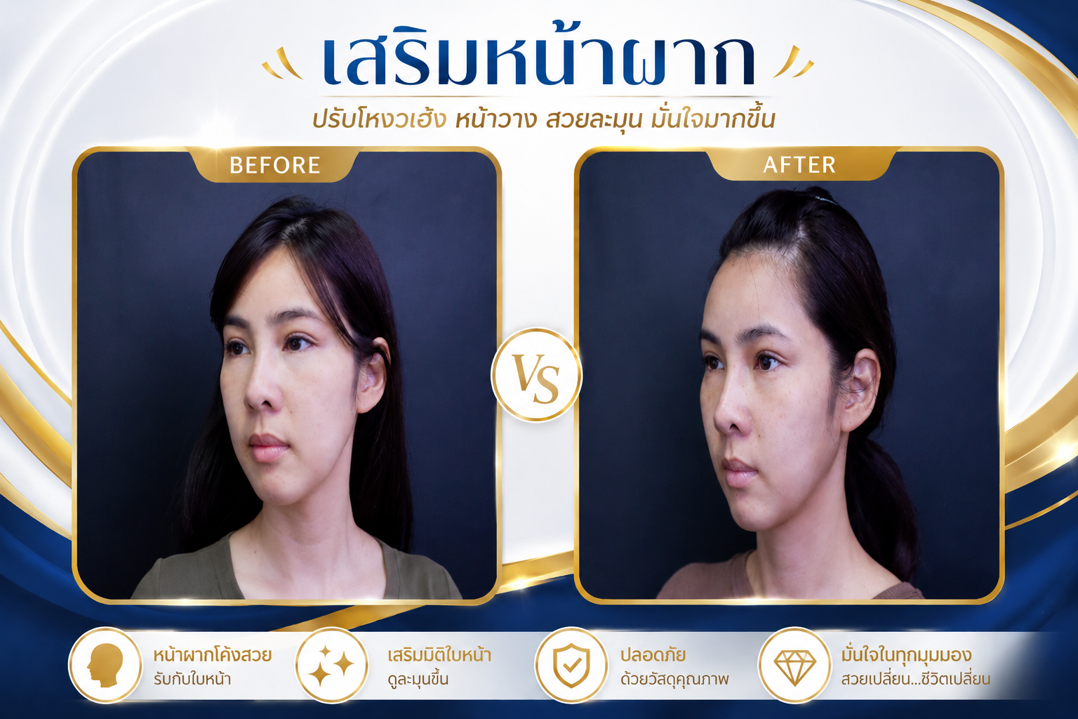 ก่อน-หลัง ศัลยกรรมใบหน้า