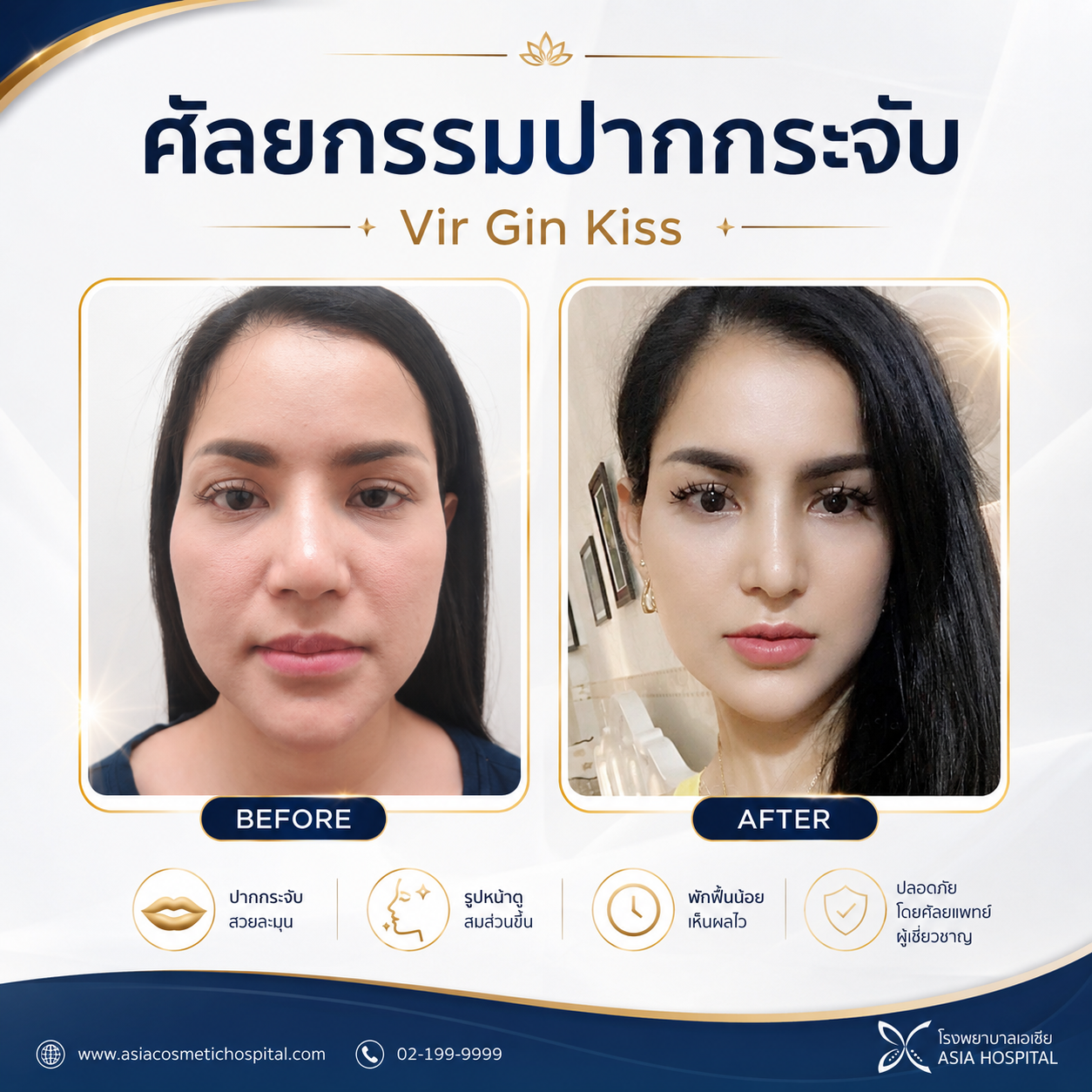 ก่อน-หลัง อื่นๆ