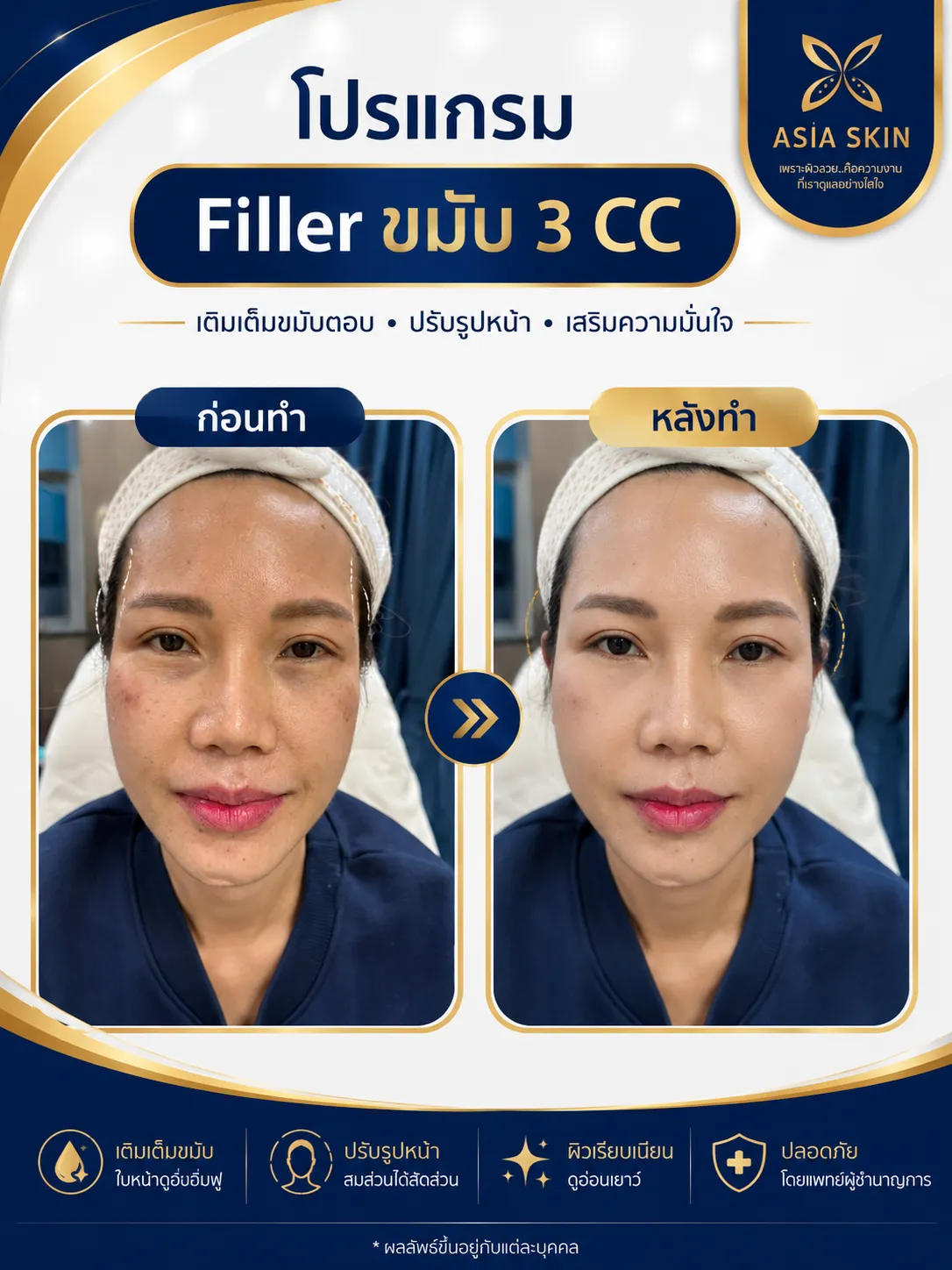 ดูแลผิวพรรณ ก่อน-หลัง