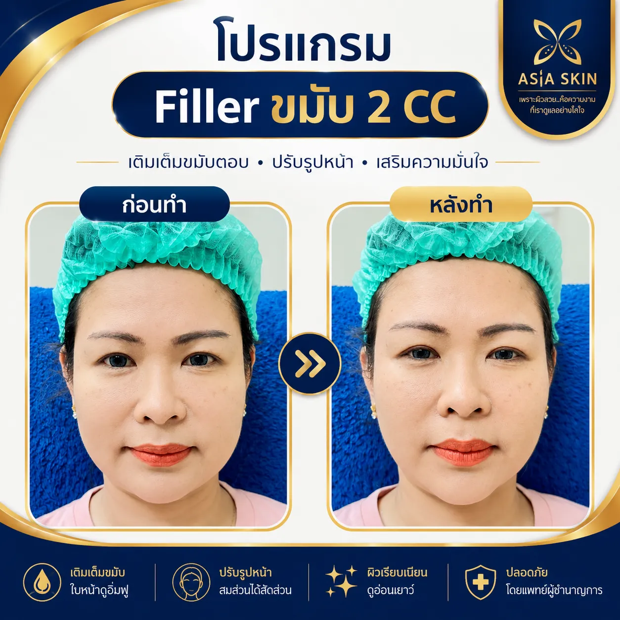 ดูแลผิวพรรณ ก่อน-หลัง